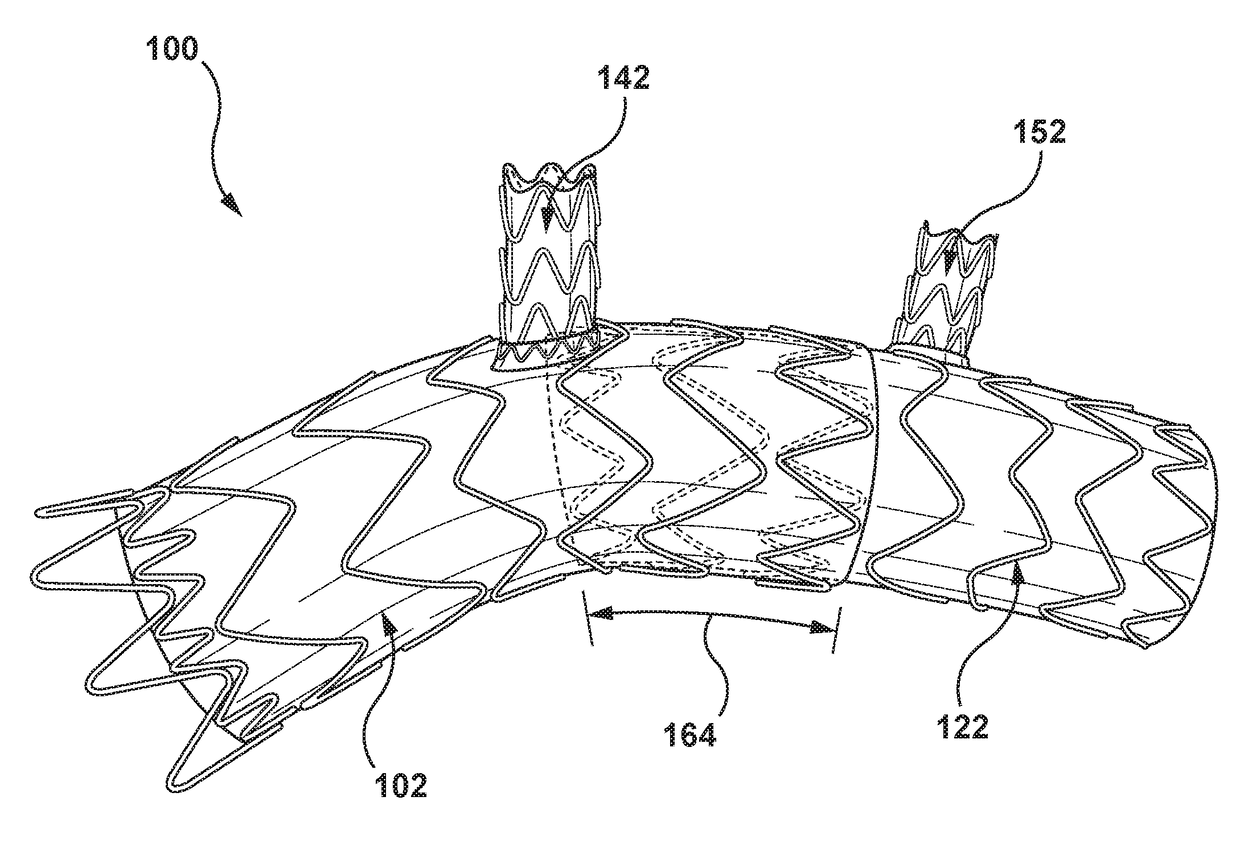 Modular aortic arch prosthetic assembly and method of use thereof