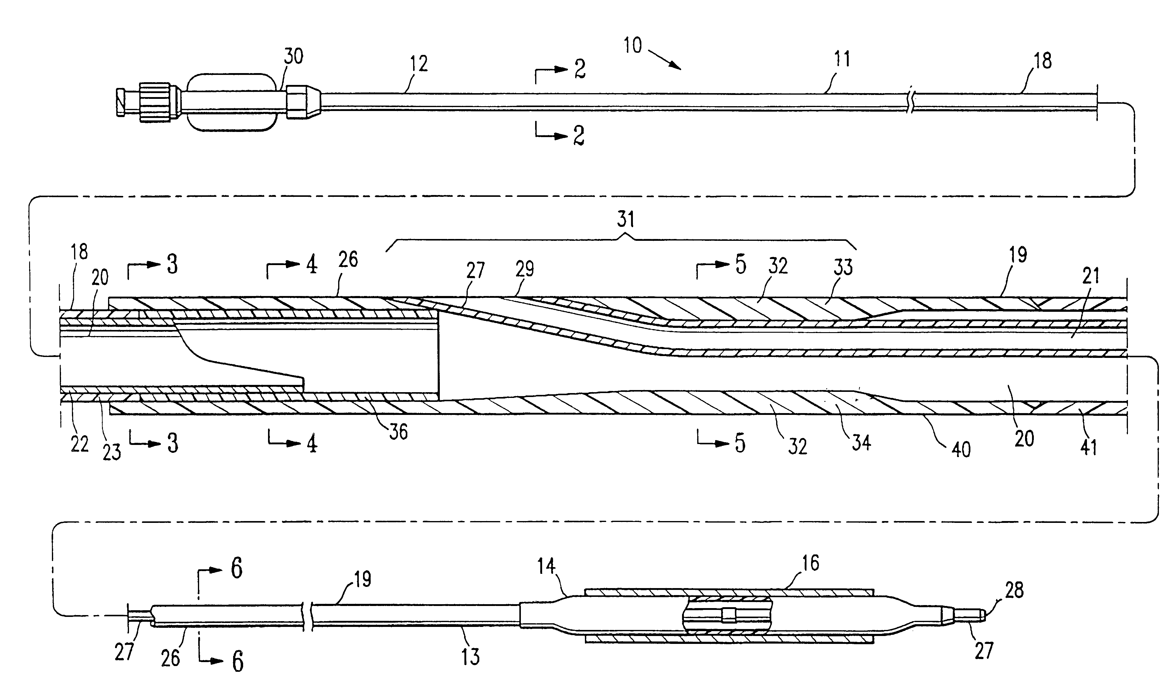 Catheter having improved rapid exchange junction