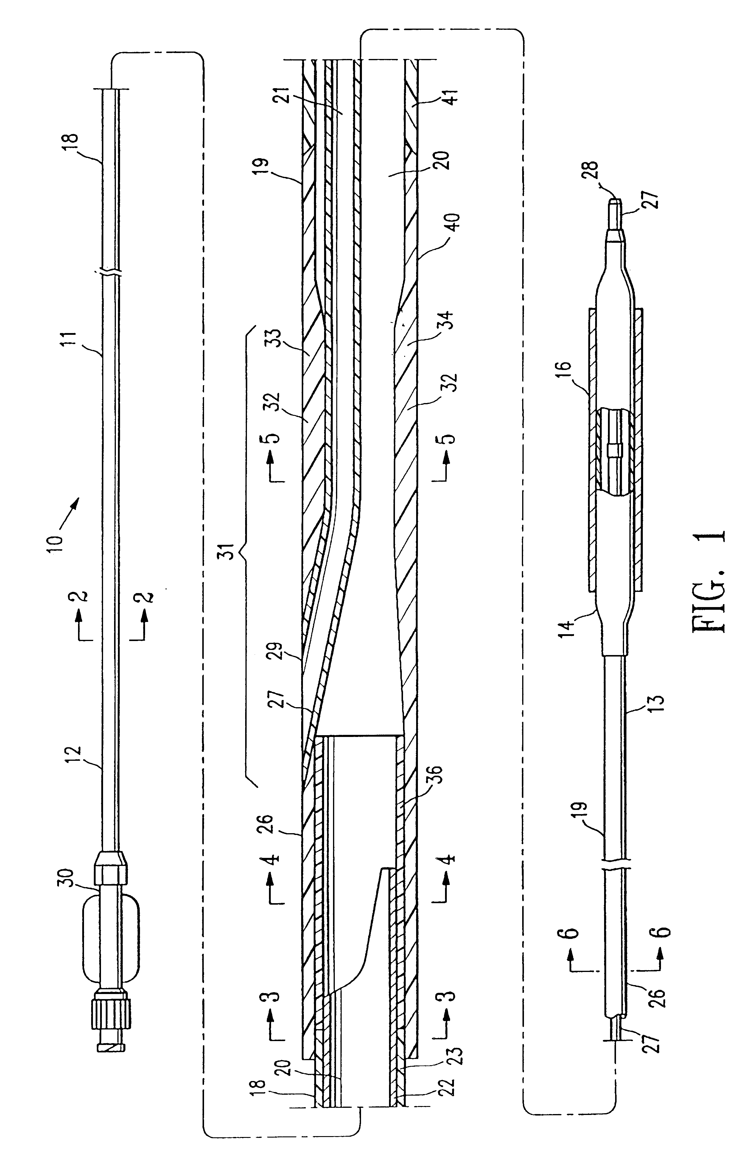 Catheter having improved rapid exchange junction