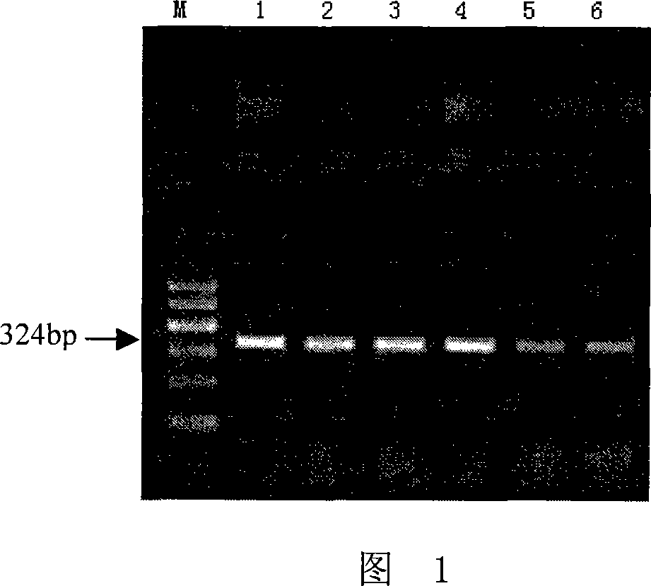 Method for sifting Holstein cow BLAD carrier and special primer and reagent case