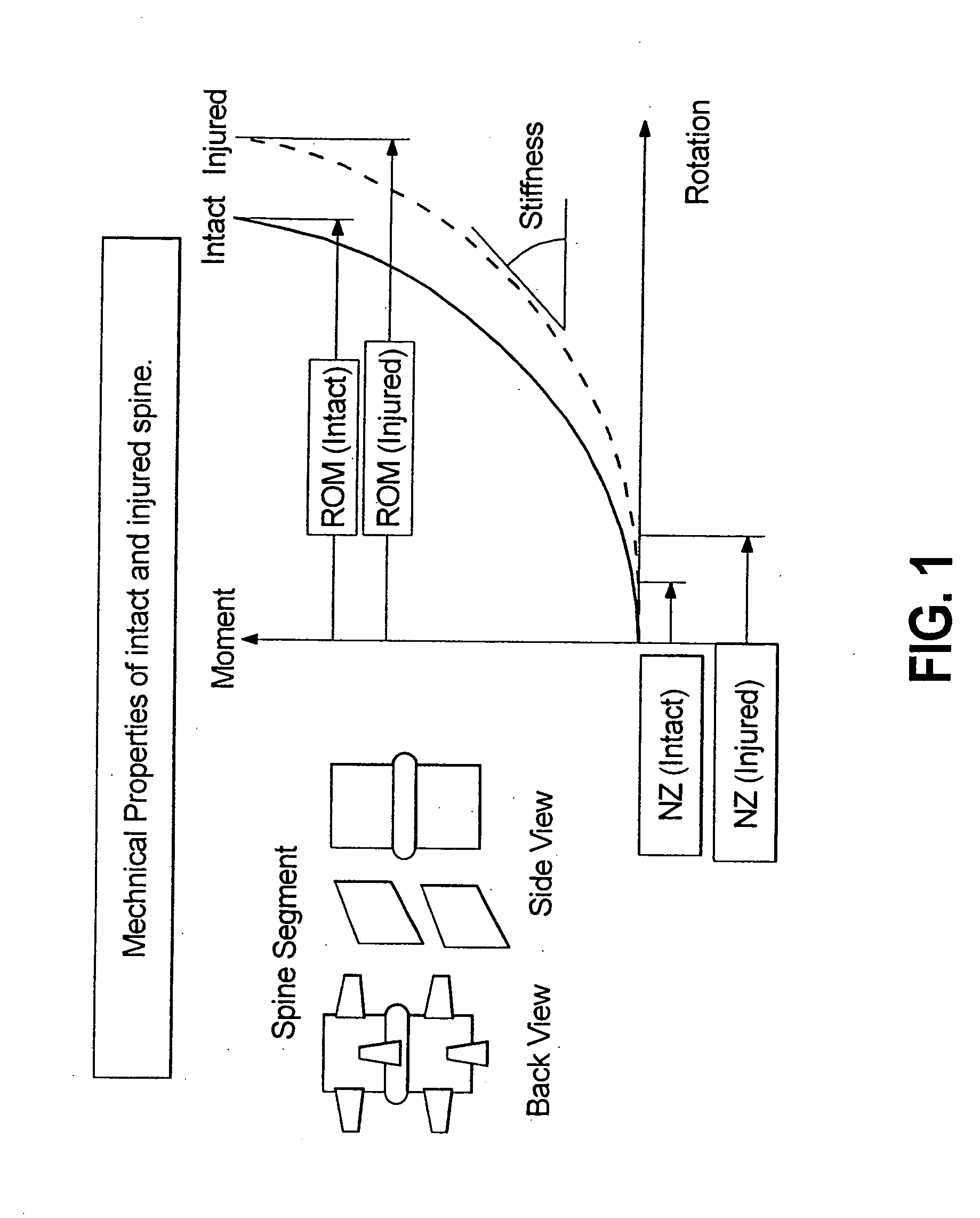 Dynamic spine stabilizer