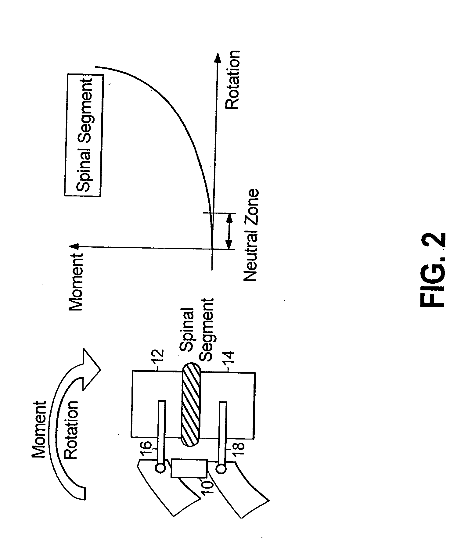 Dynamic spine stabilizer