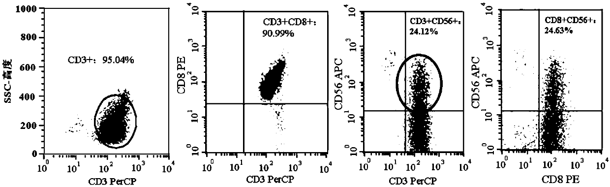 Chimeric antigen receptor, gene thereof and recombinant expression vector of gene as well as CARMSLN-NKT cell and preparation method and application of CARMSLN-NKT cell