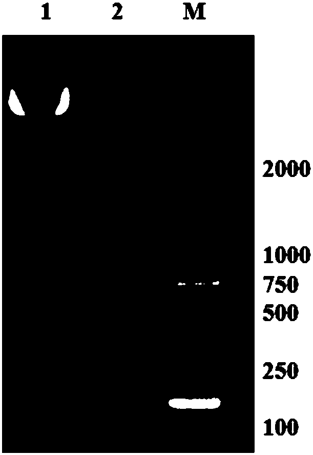 Chimeric antigen receptor, gene thereof and recombinant expression vector of gene as well as CARMSLN-NKT cell and preparation method and application of CARMSLN-NKT cell