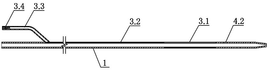 Percutaneous transhepatic implanted multifunctional biliary drainage device