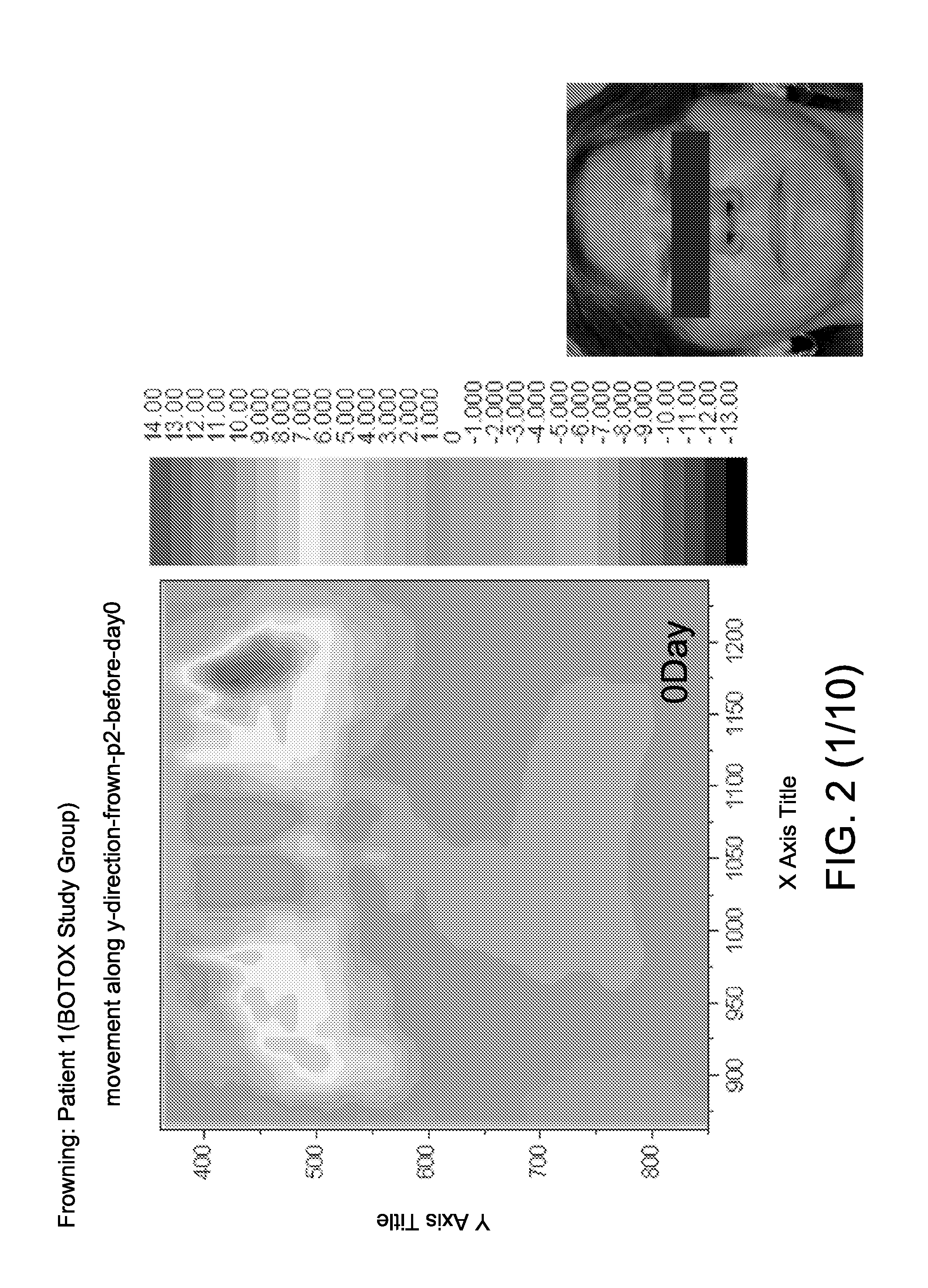 Methods Useful in Optimizing the Treatment of Neuropathies and Targeting Tissues with Cosmetic Botulinum Injections