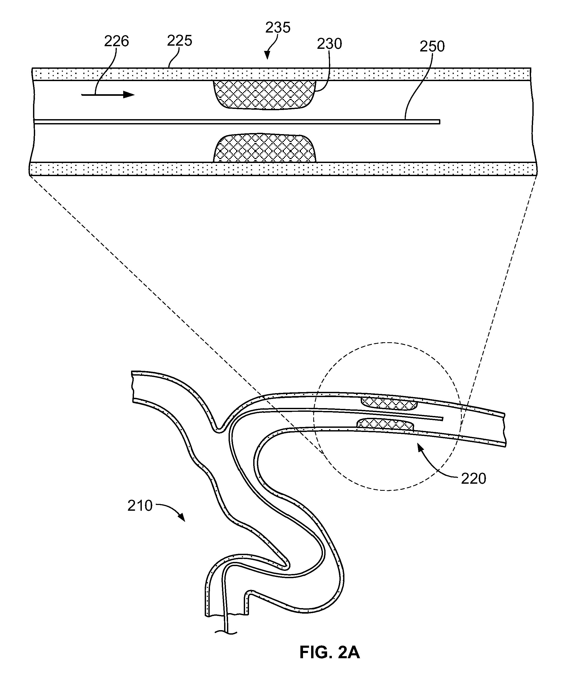 Devices and systems for thrombus treatment