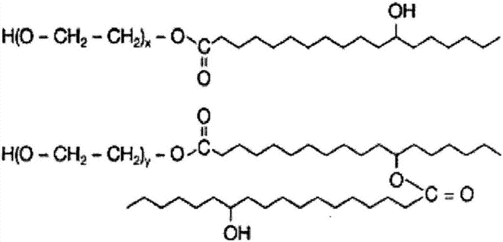 Butyphthalide injection and preparation method thereof