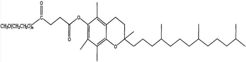 Butyphthalide injection and preparation method thereof