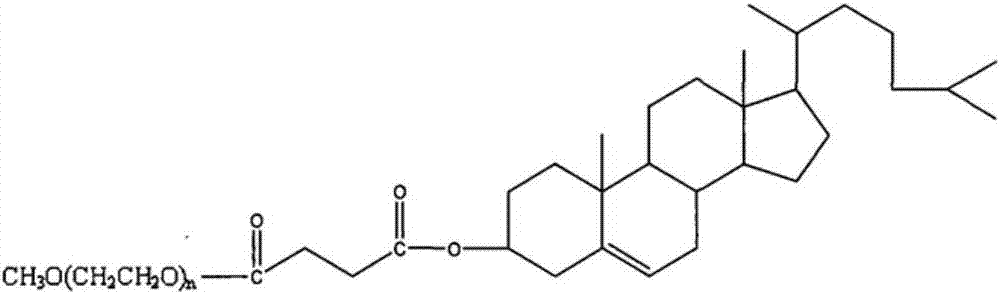 Butyphthalide injection and preparation method thereof