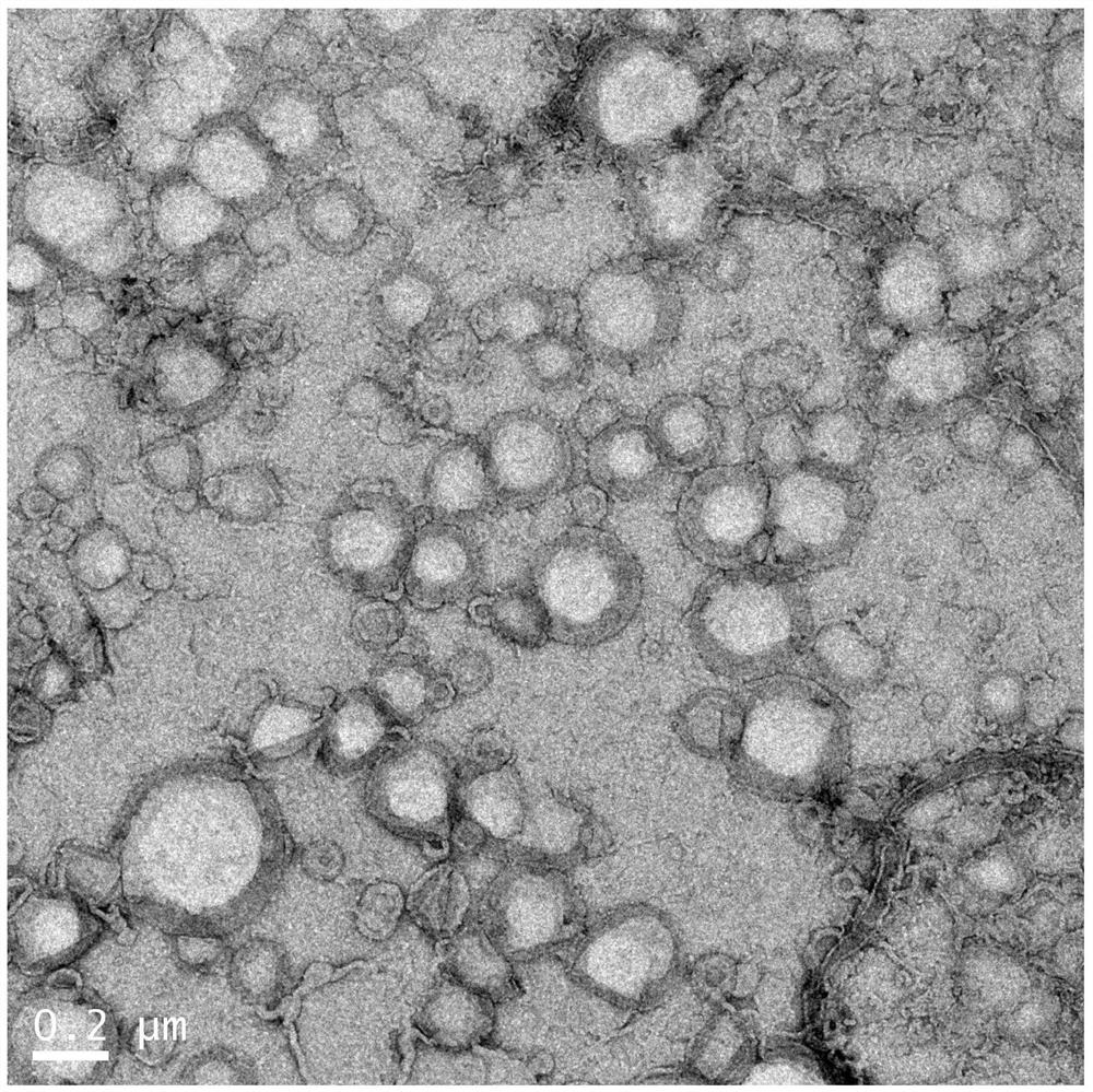 Bufalin (BUF)-carrying nano liposome modified by hyaluronic acid as well as preparation method and application of BUF-carrying nano liposome