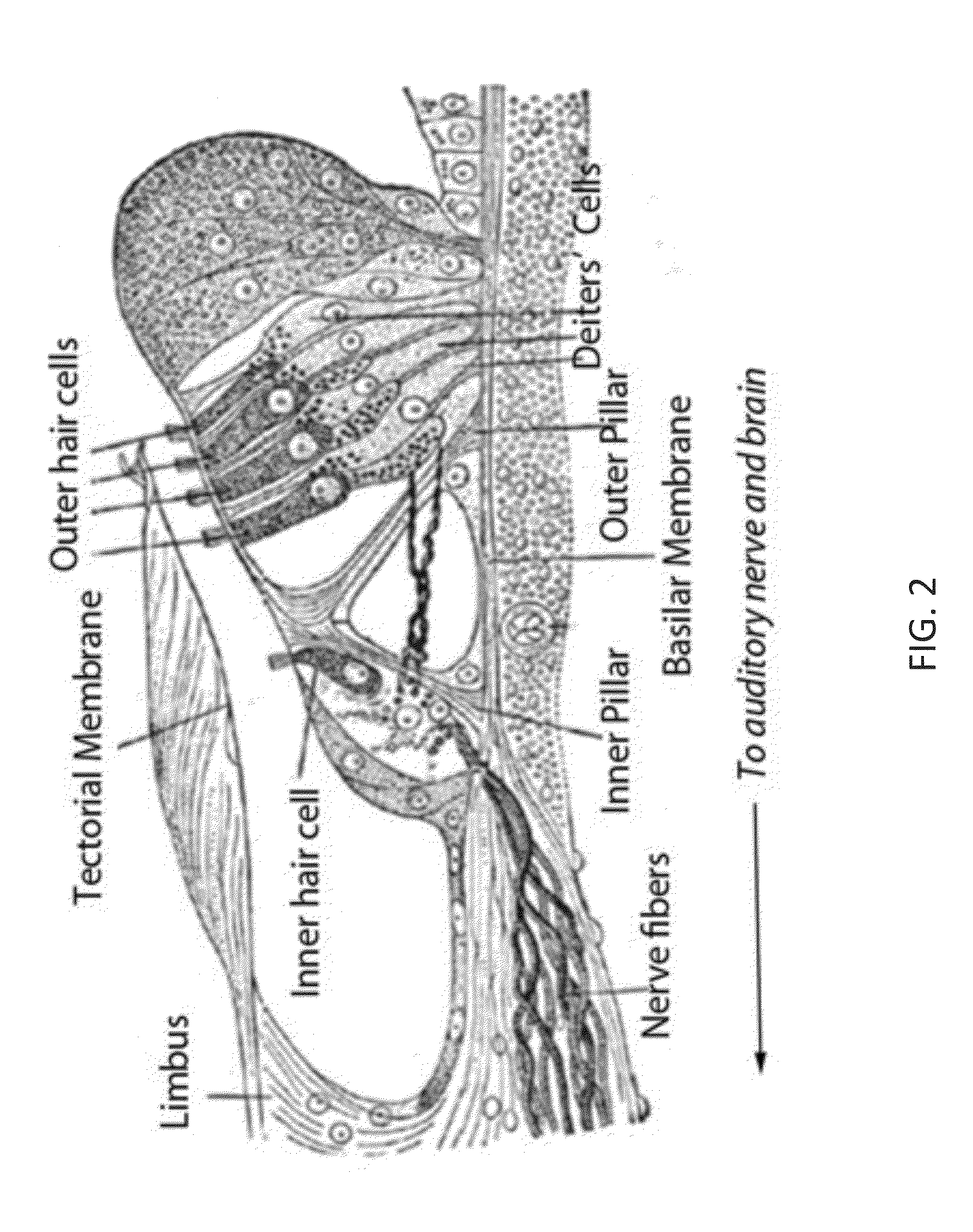 Local cochlear application of statins for stimulating neurite regrowth in the cochlea