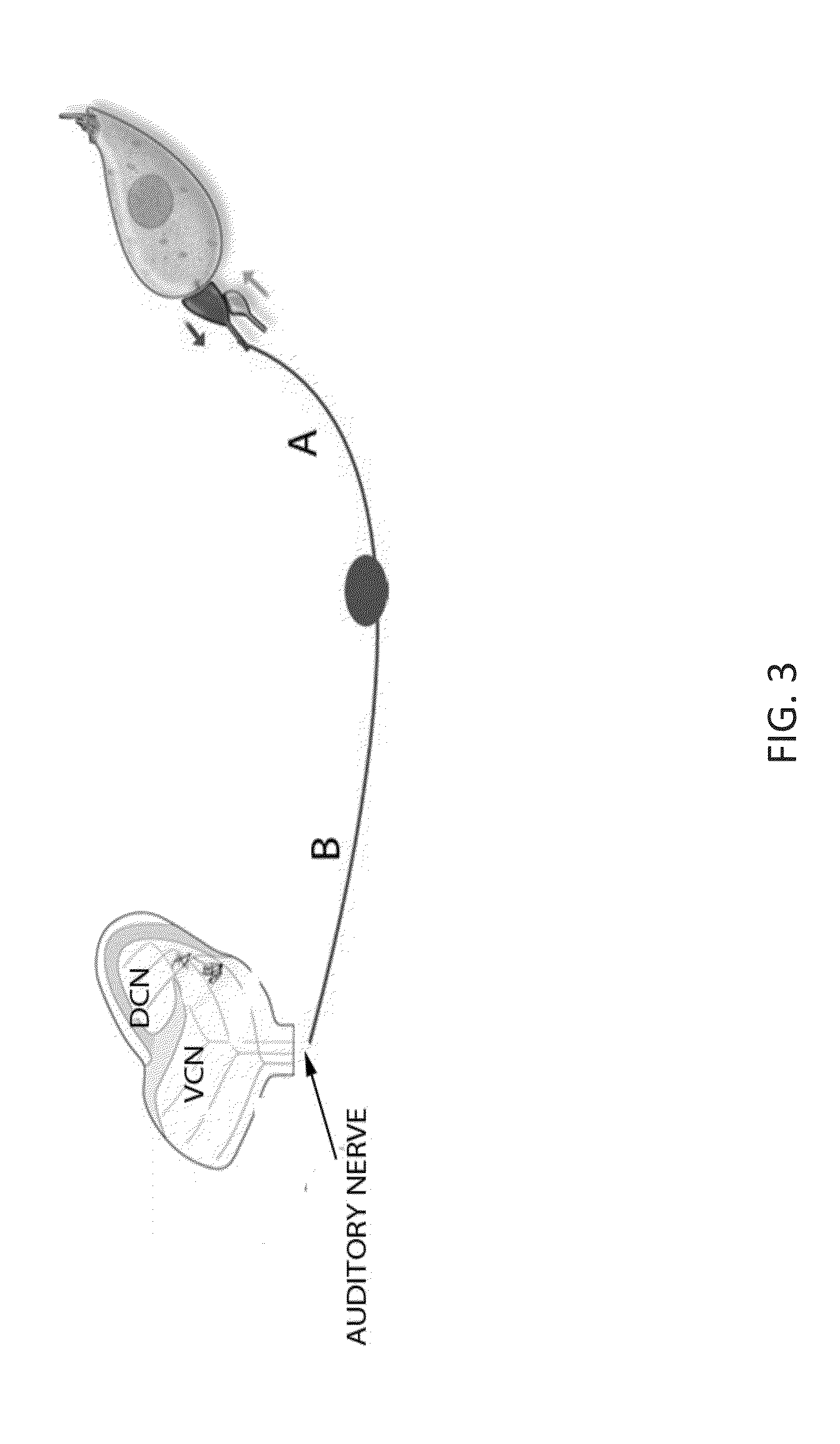 Local cochlear application of statins for stimulating neurite regrowth in the cochlea