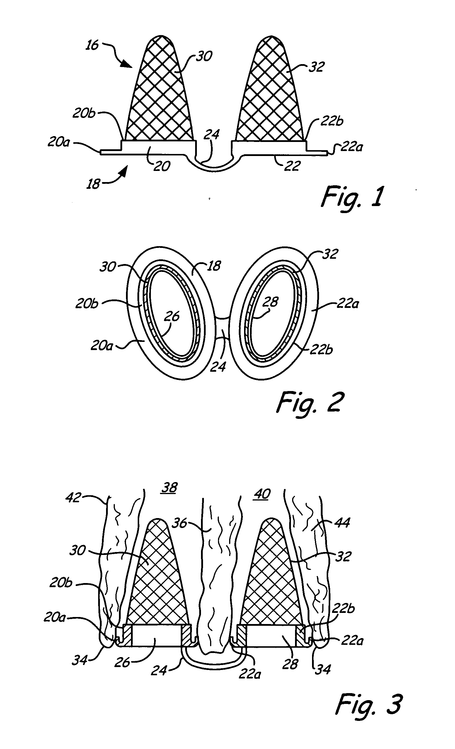 Breathing air filtration system