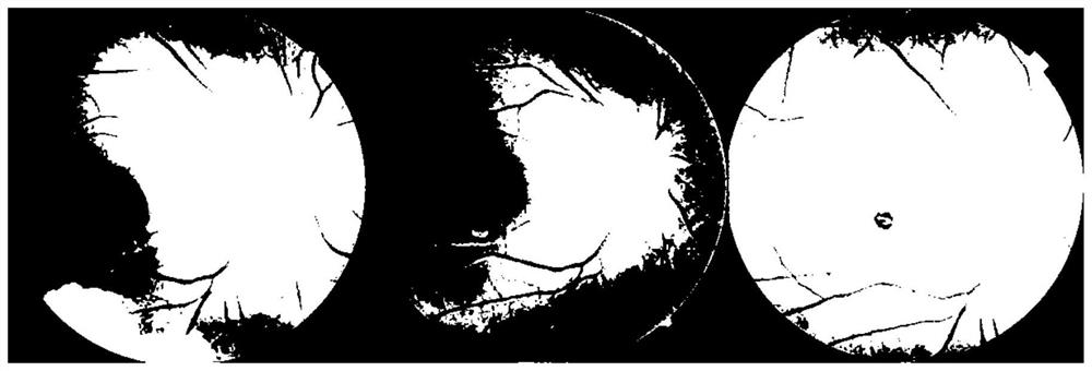 Fundus image processing method, model training method and equipment