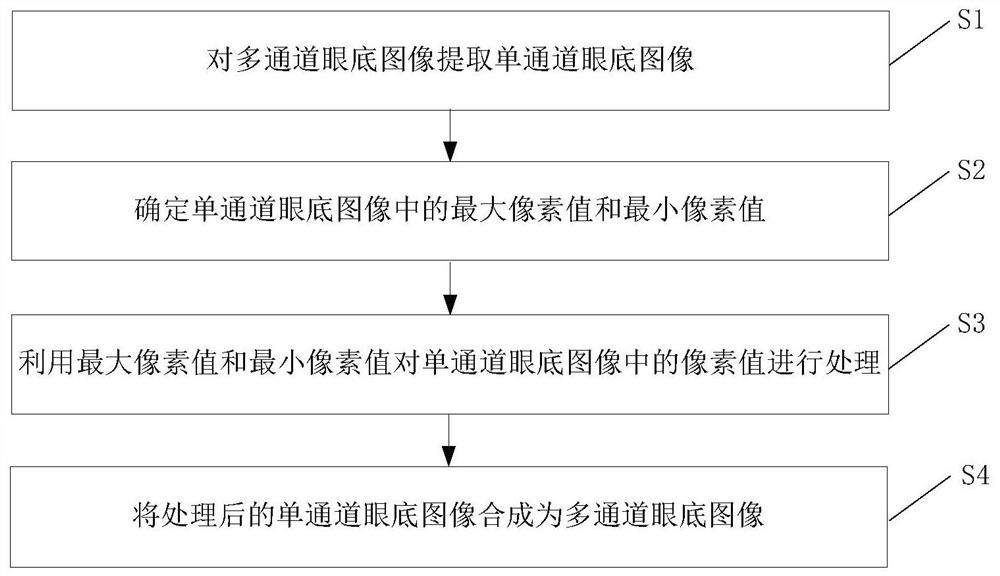 Fundus image processing method, model training method and equipment