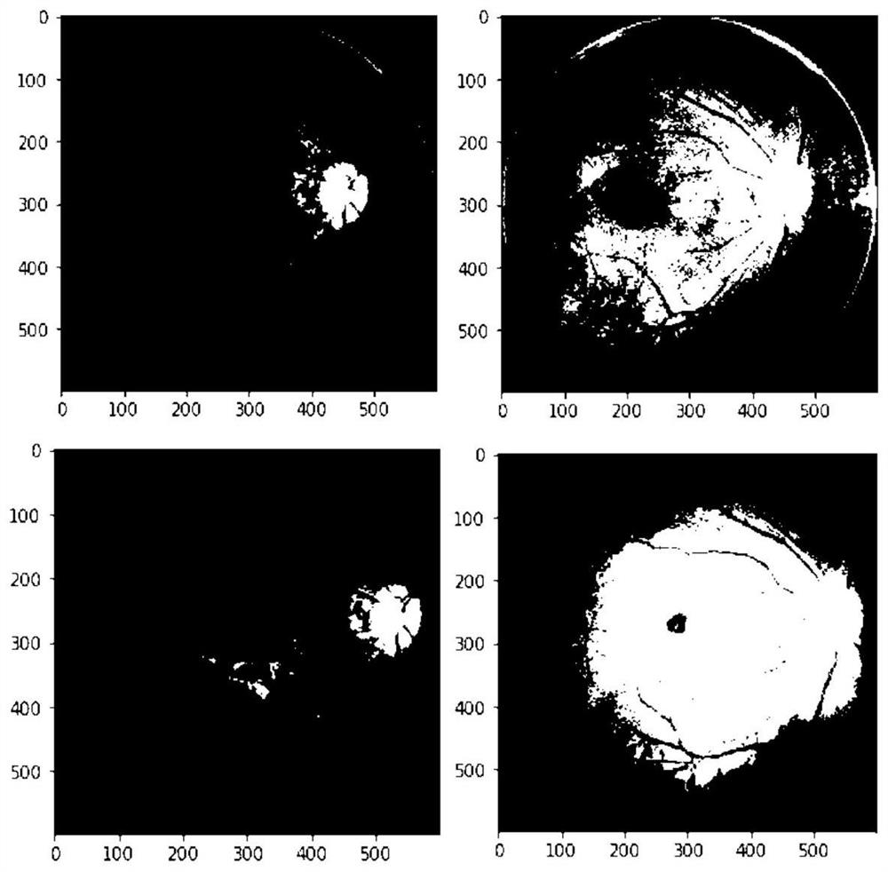 Fundus image processing method, model training method and equipment