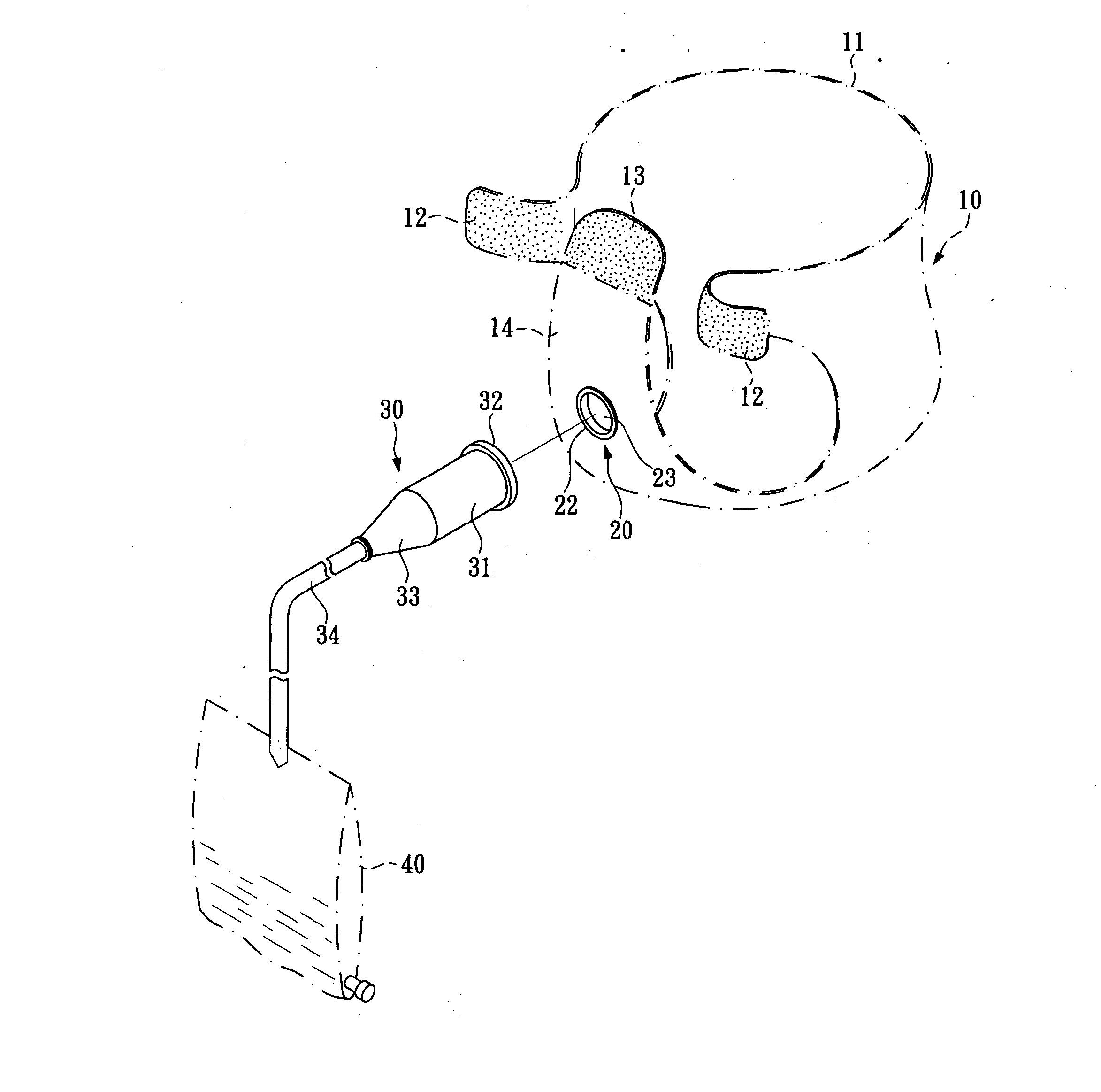 Clothing article incorporated with urine drainage device