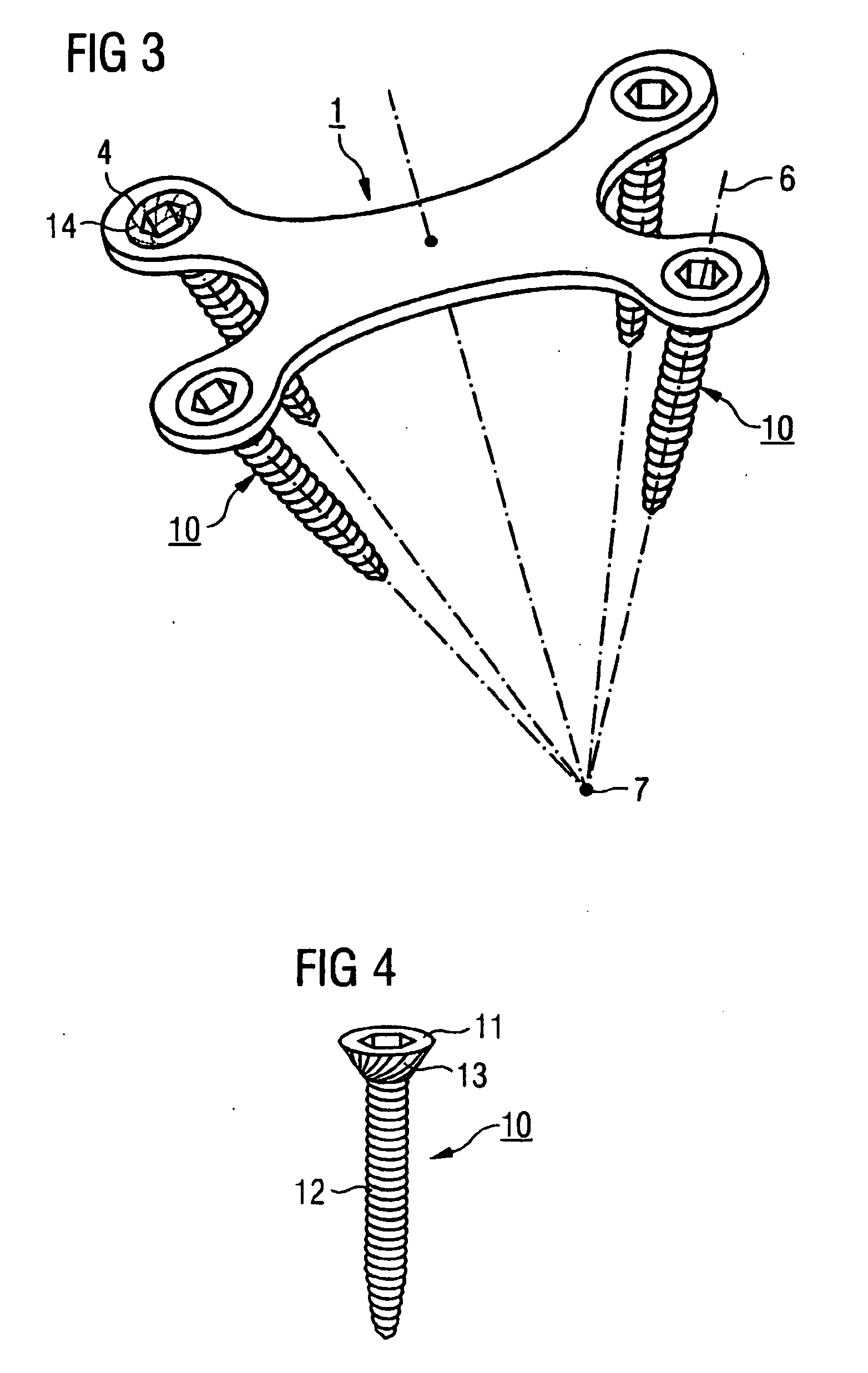 Bone plate