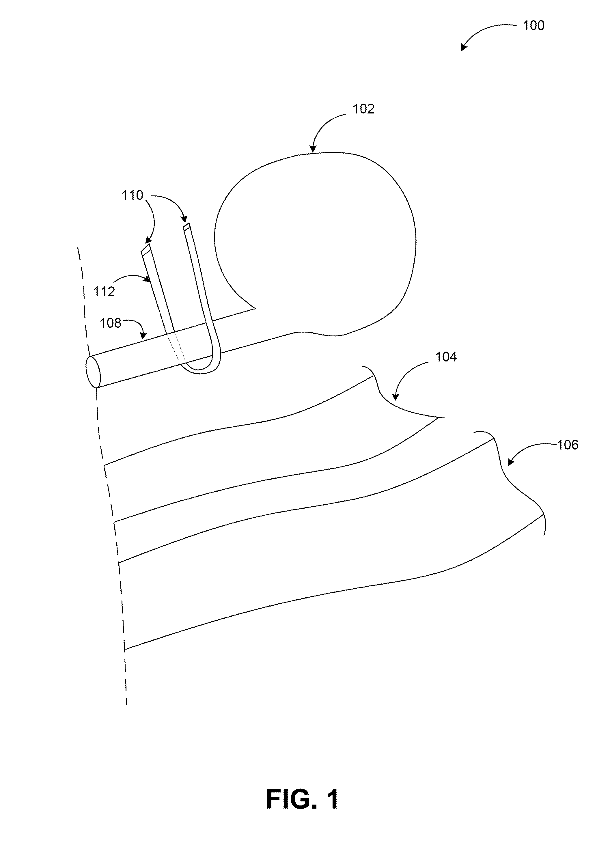 Trans-urethral sling delivery device