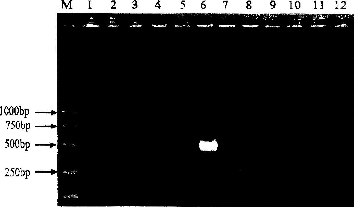 Reagent kit and detection method for quickly detecting shark vibrio