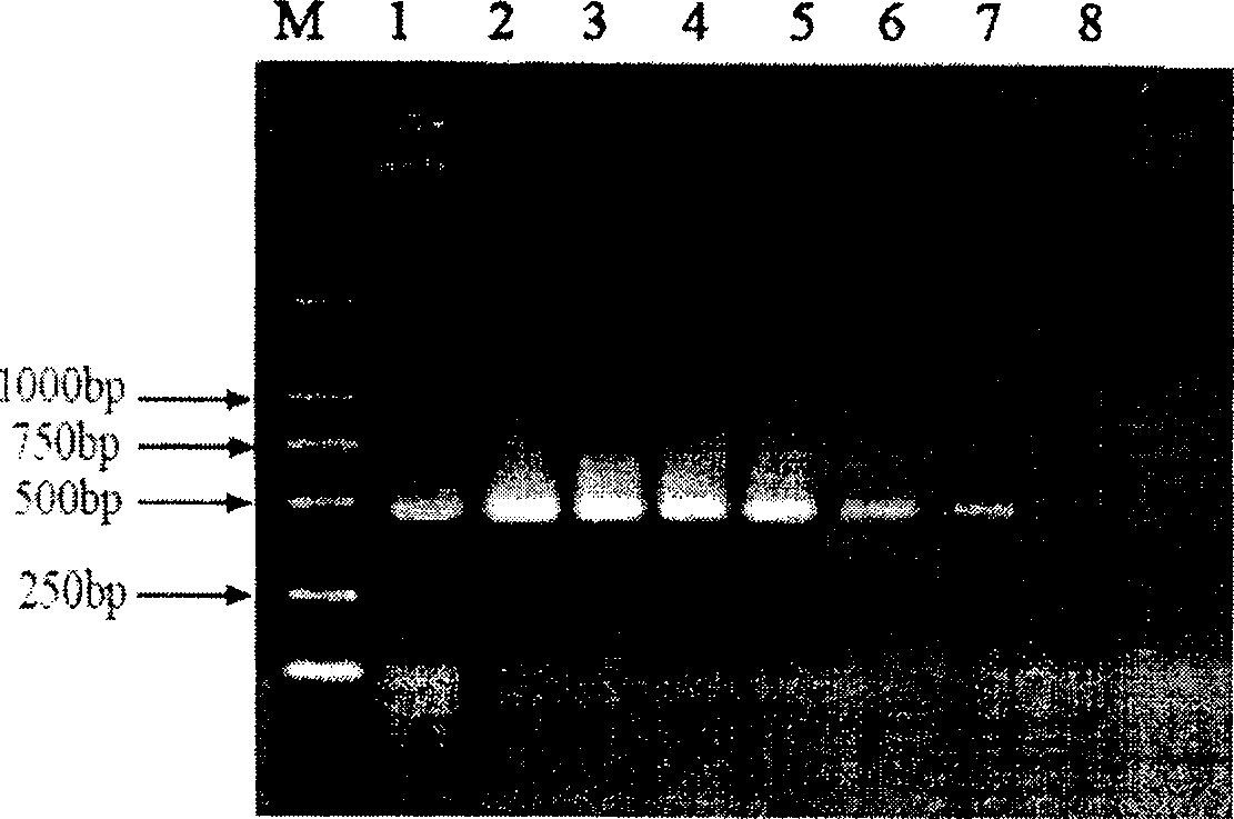 Reagent kit and detection method for quickly detecting shark vibrio