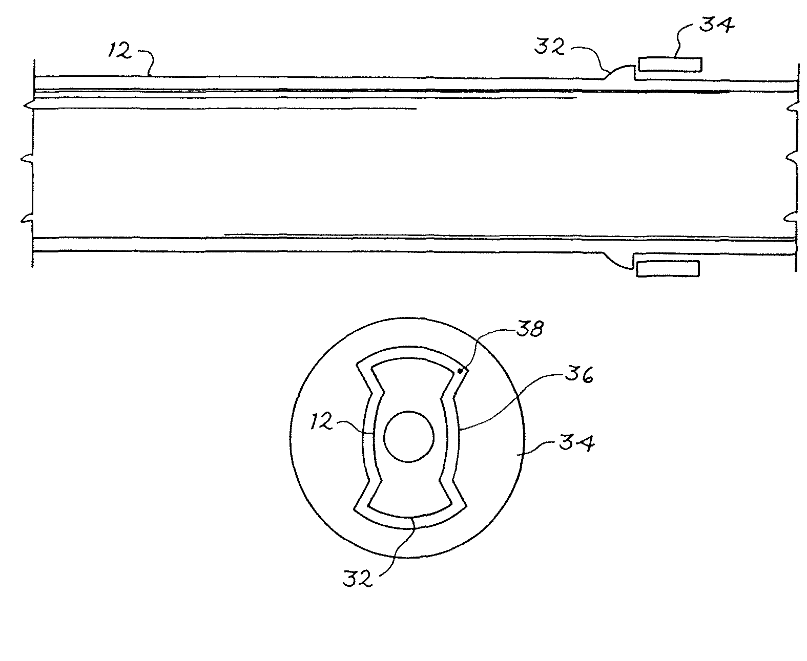 Sequential implant delivery system