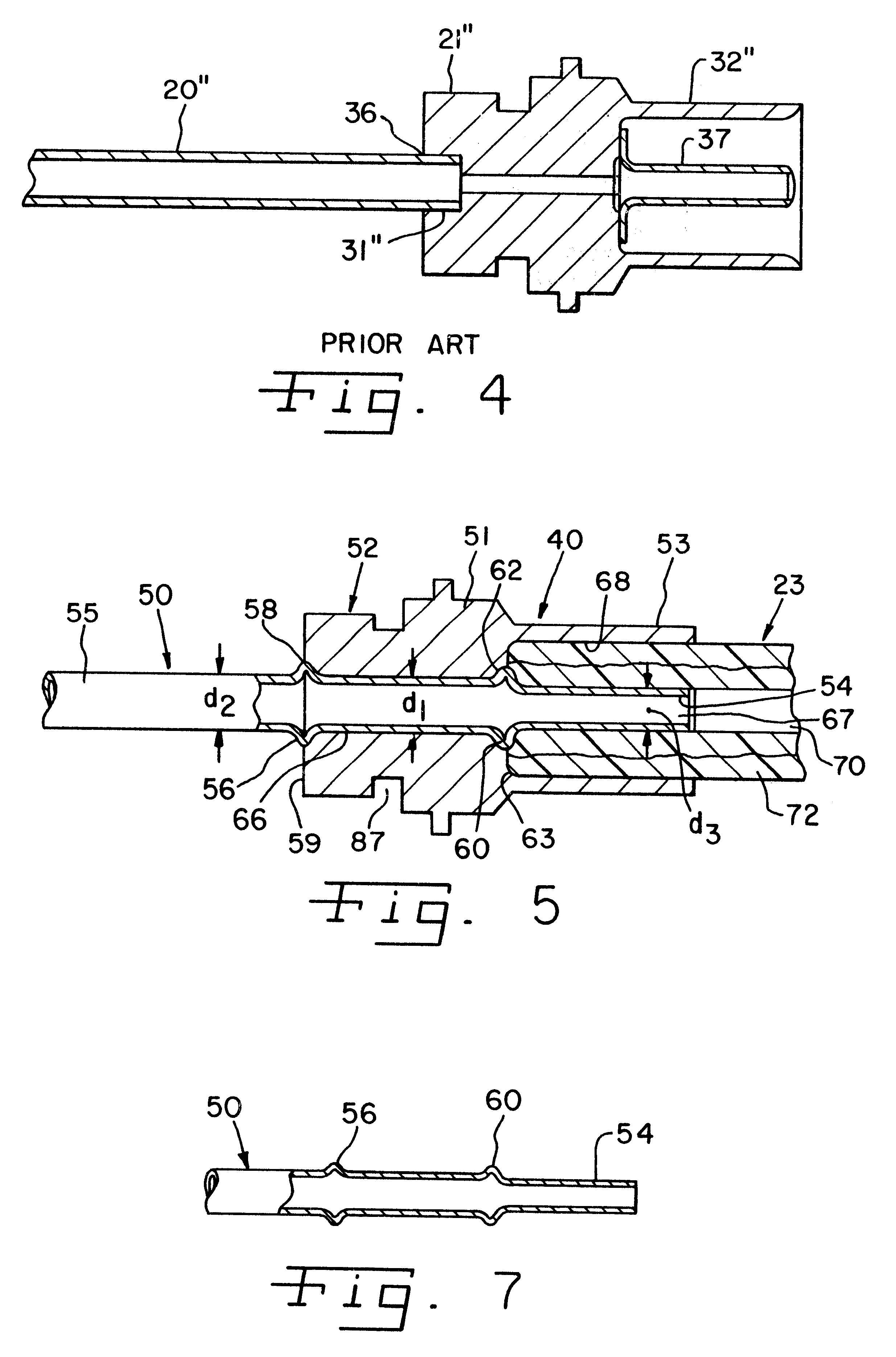 High-pressure integral tube coupling arrangements