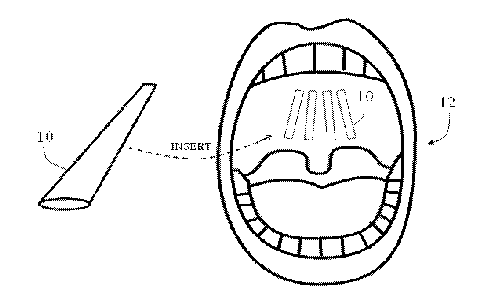 Tissue crosslinking for treatment of snoring and obstructive sleep apnea