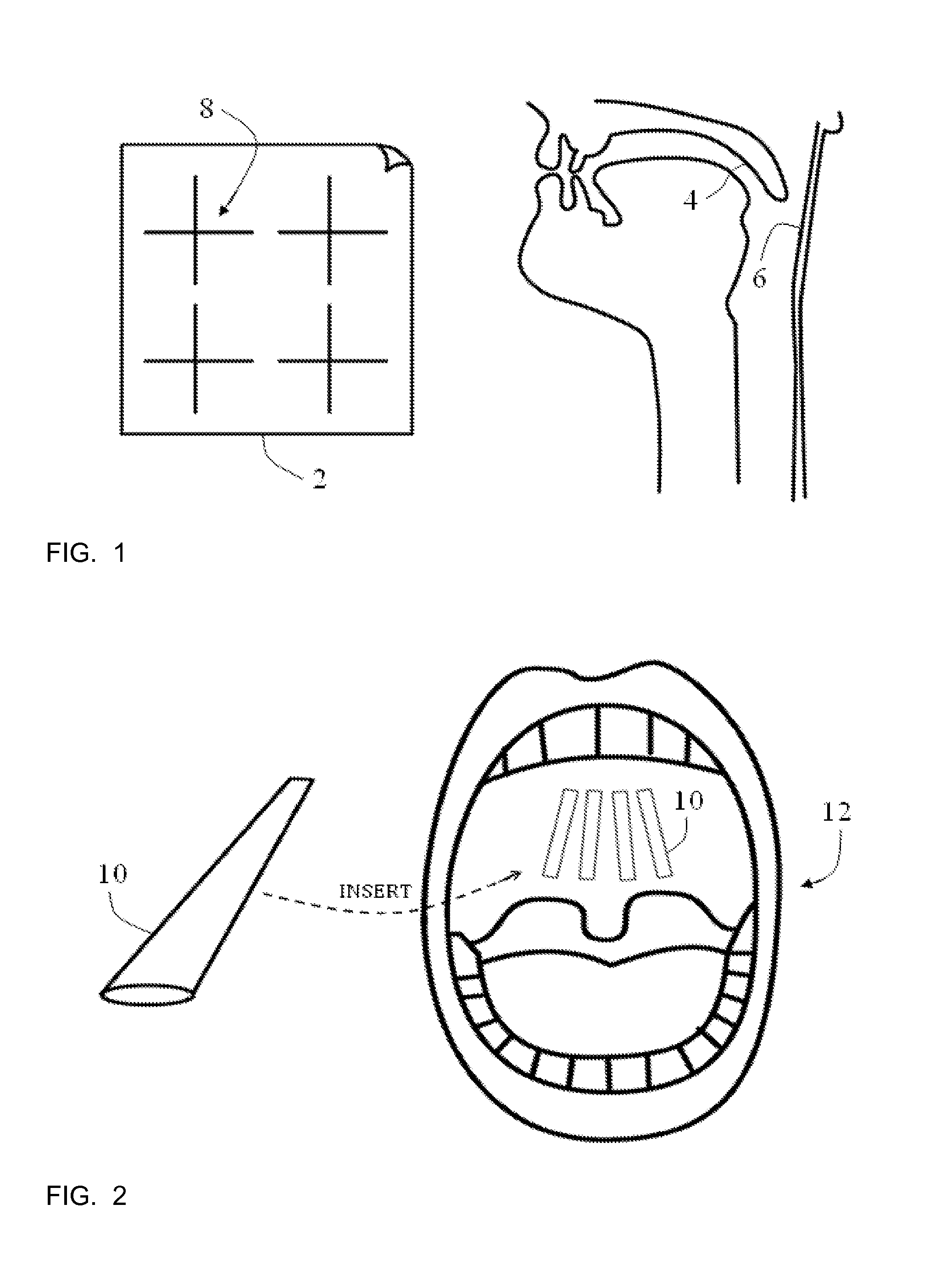 Tissue crosslinking for treatment of snoring and obstructive sleep apnea