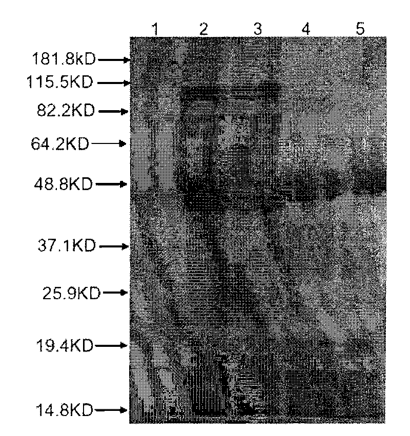 Recombination outer membrane protein, coding gene and expression vector of porcine actinobacillus pleuropneumoniae (APP) and preparation method thereof