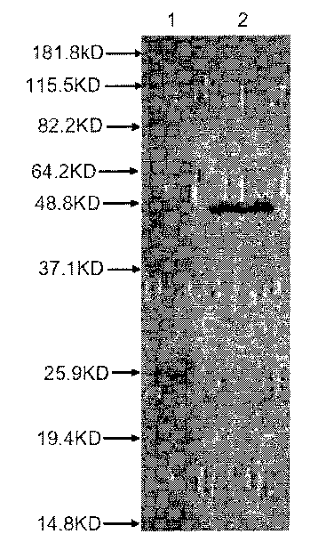 Recombination outer membrane protein, coding gene and expression vector of porcine actinobacillus pleuropneumoniae (APP) and preparation method thereof