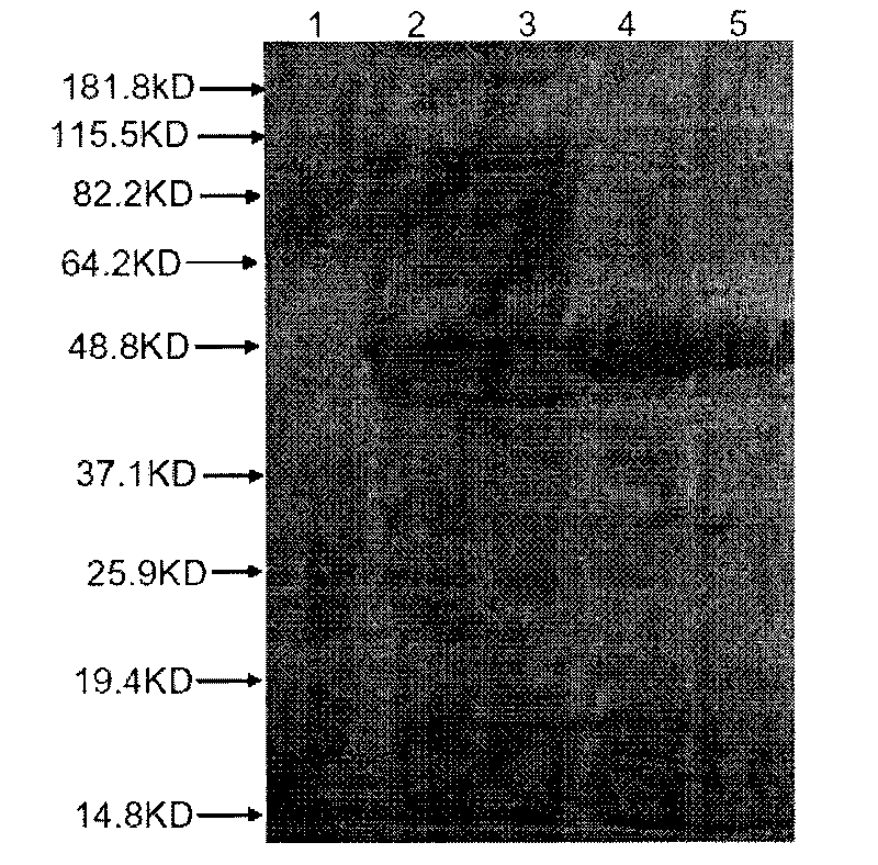 Recombination outer membrane protein, coding gene and expression vector of porcine actinobacillus pleuropneumoniae (APP) and preparation method thereof