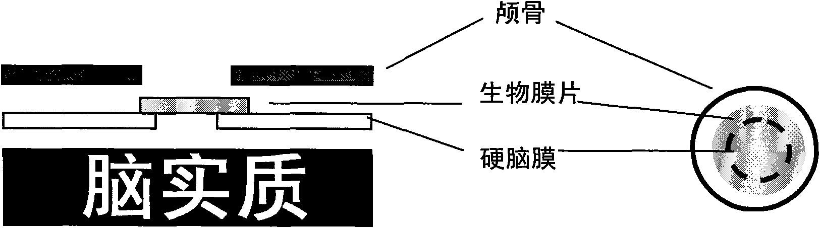 I-type medical collagen material keeping original specific triple helix structure of collagen, product and application thereof