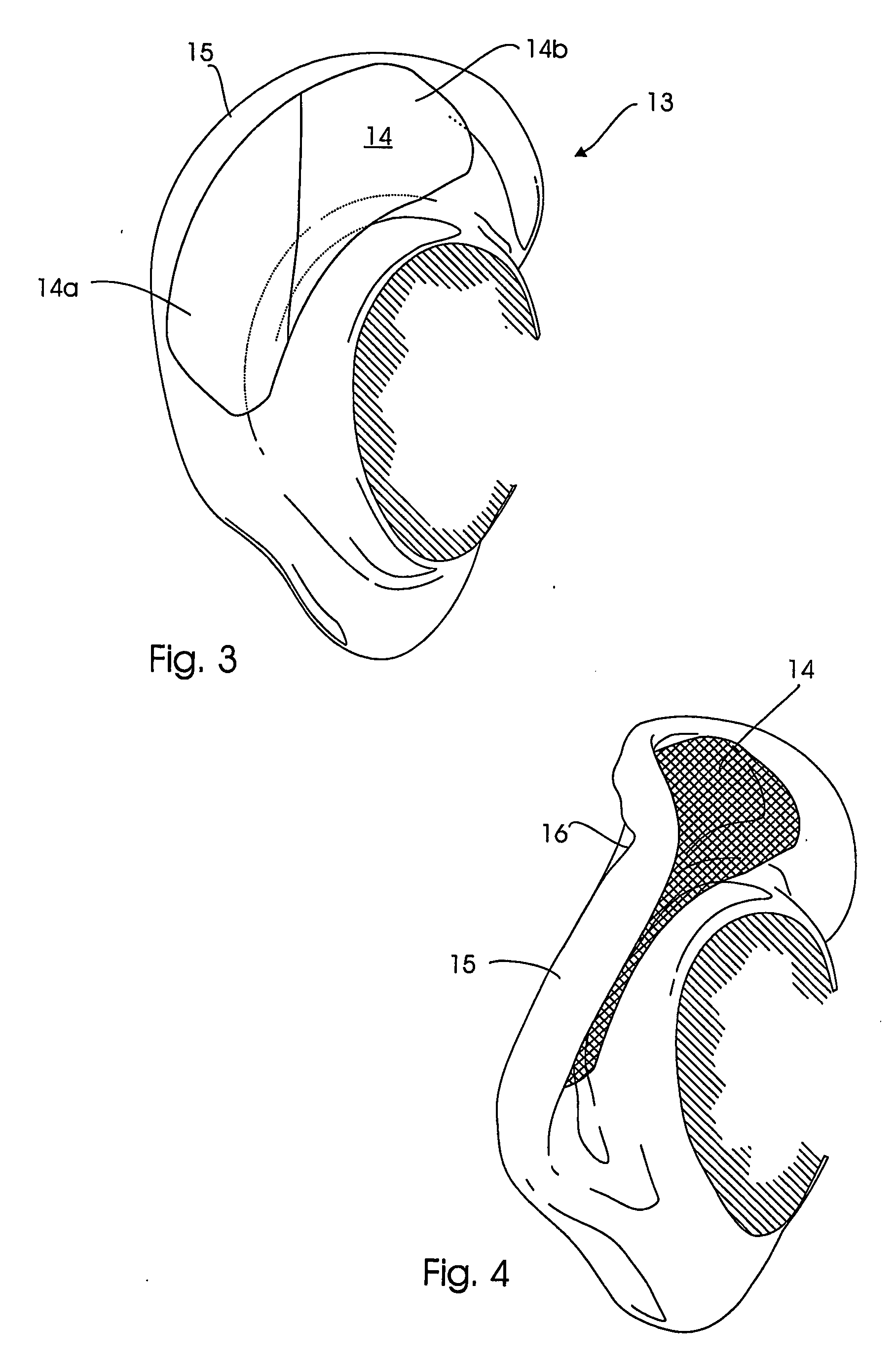 Clamp for correcting the external ear and method of using the clamp