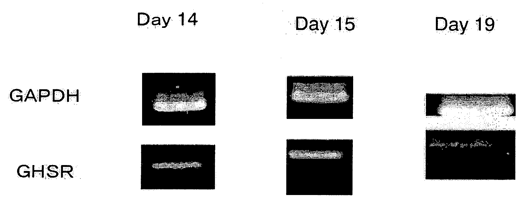 Skin Repair Accelerating Therapeutic Agent Containing Ghrelin and Derivatives Thereof or Substance Acting On GHS-R1a as Active Ingredient