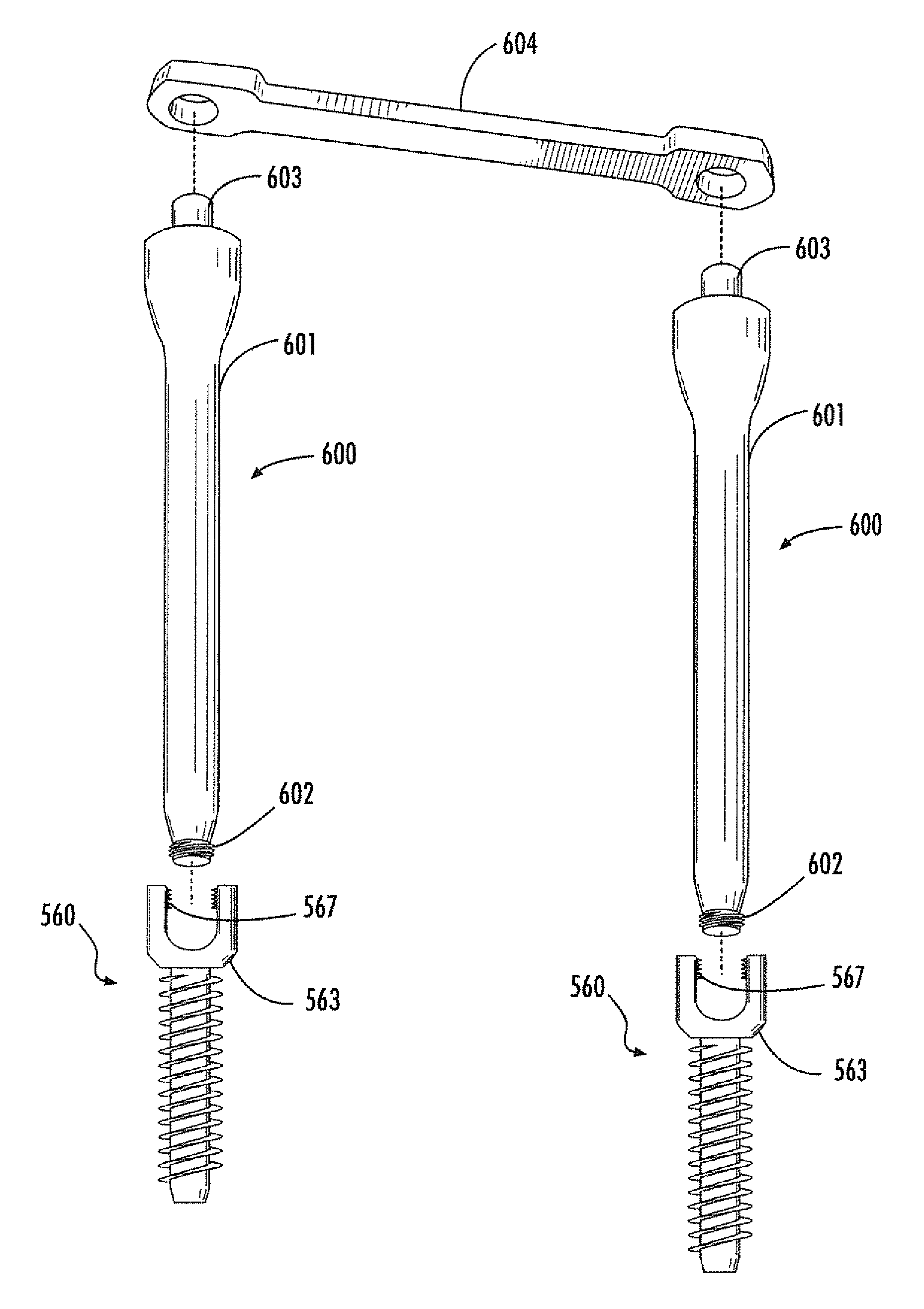 Surgical devices and methods providing sacroiliac stabilization