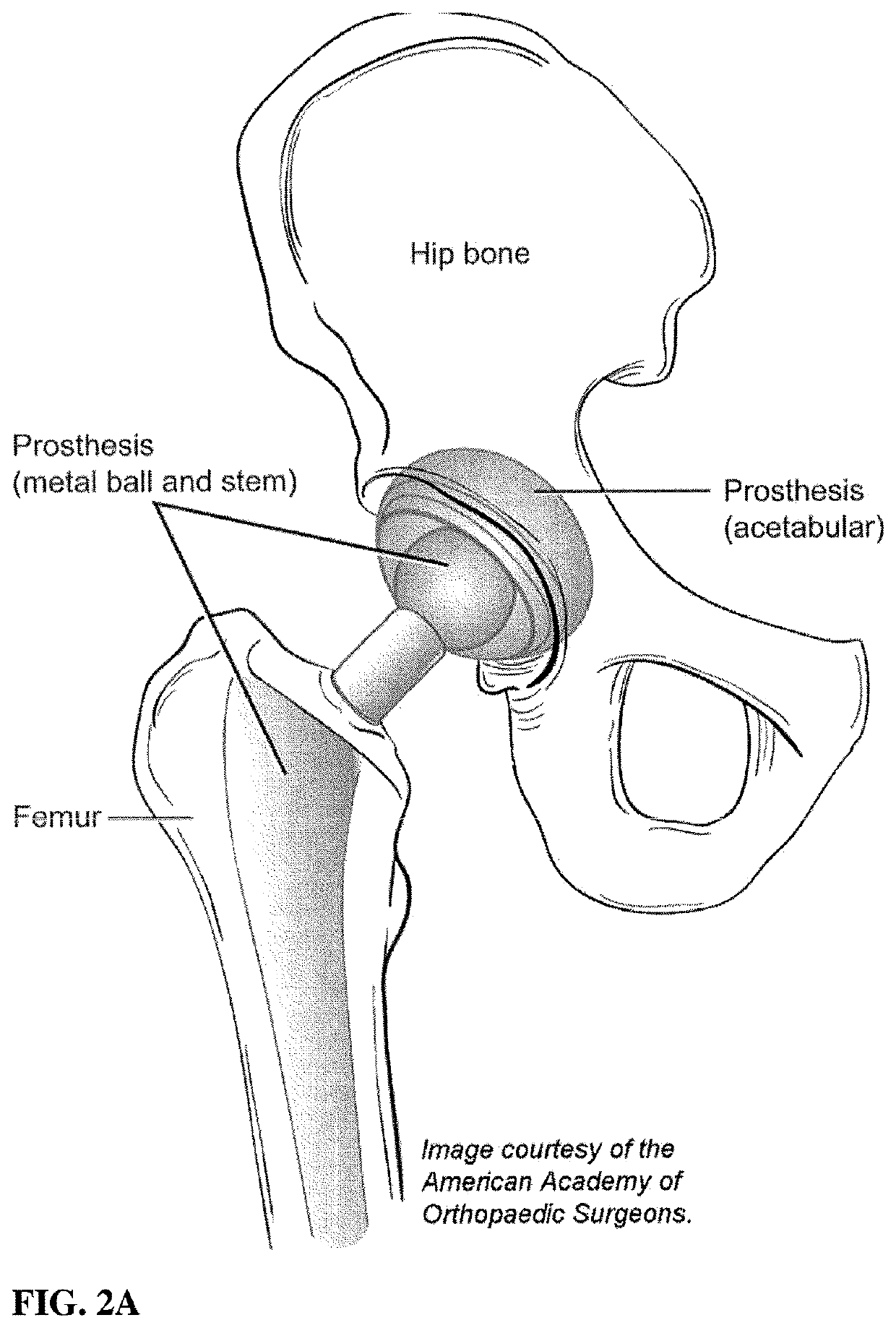 Medical device coating with a biocompatible layer