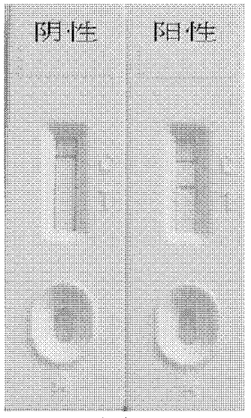 Listeria monocytogenes nucleic acid chromatography detection kit, its detection method and application thereof