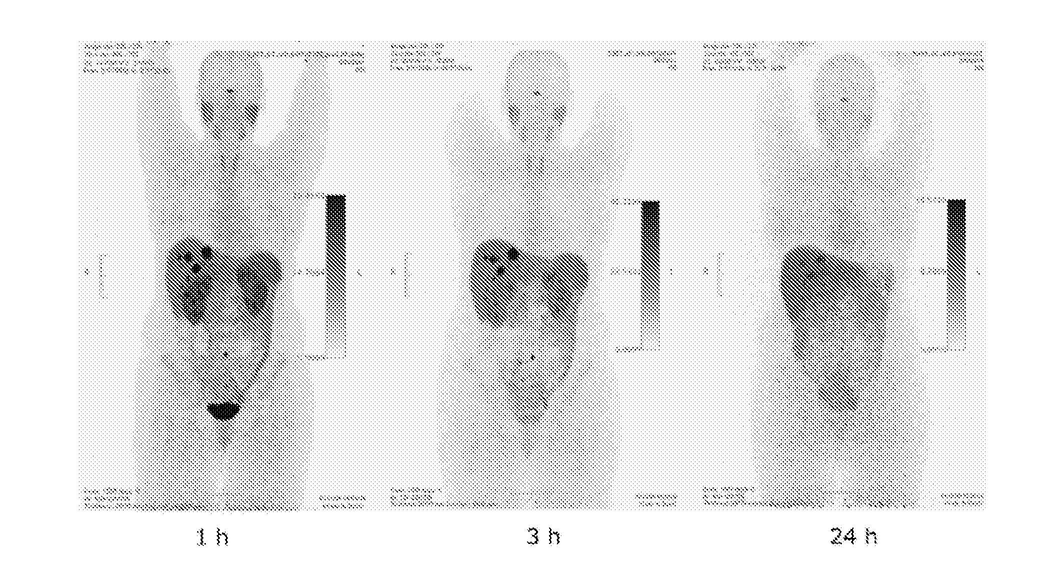 Pet tracer for imaging of neuroendocrine tumors