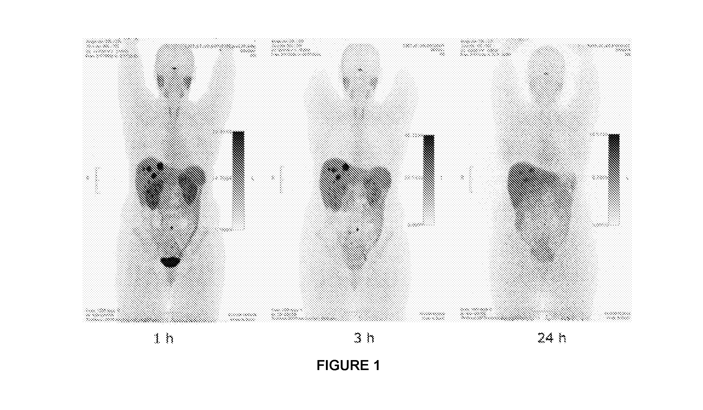 Pet tracer for imaging of neuroendocrine tumors