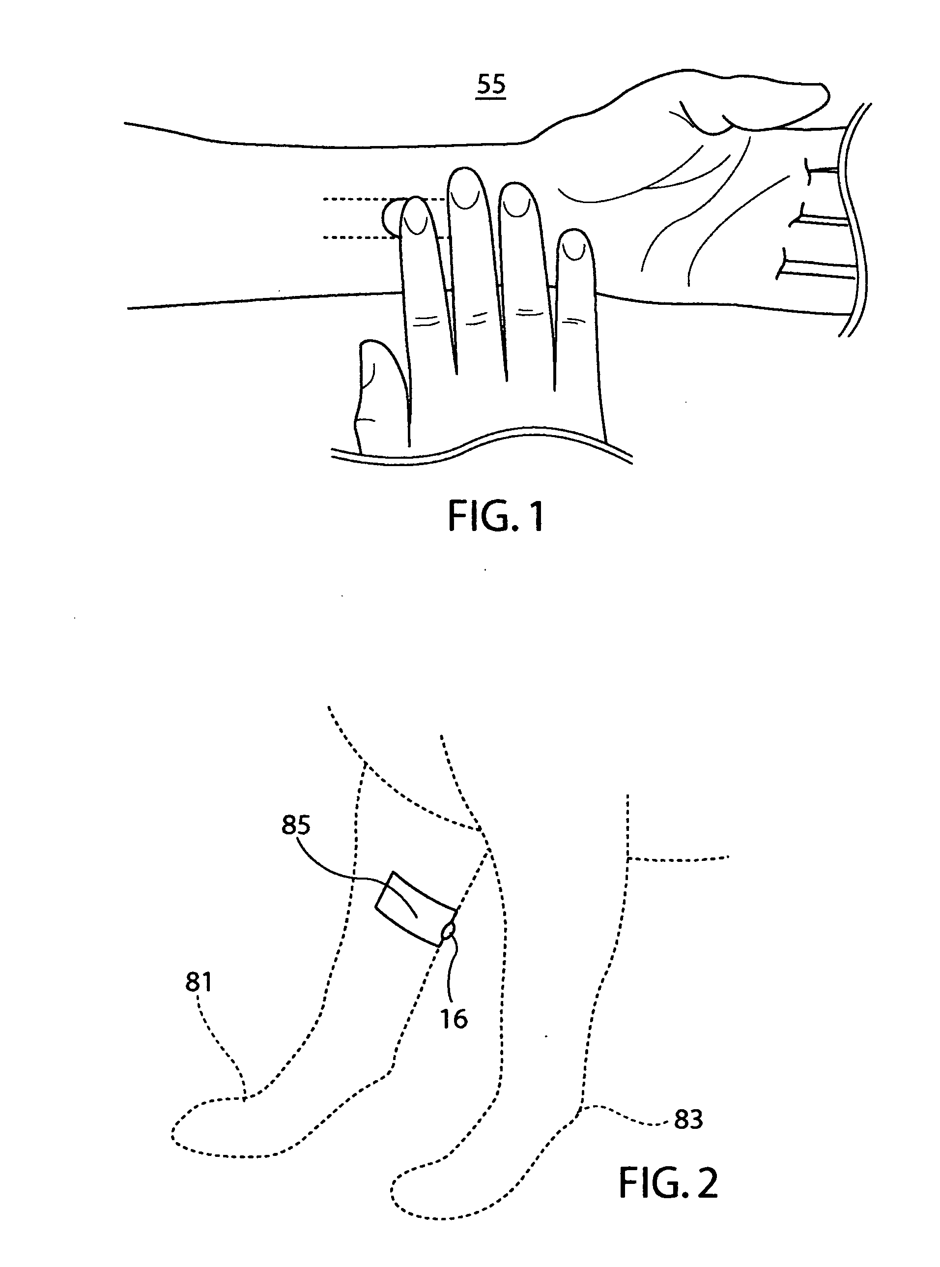 Disposable acupressure relief band