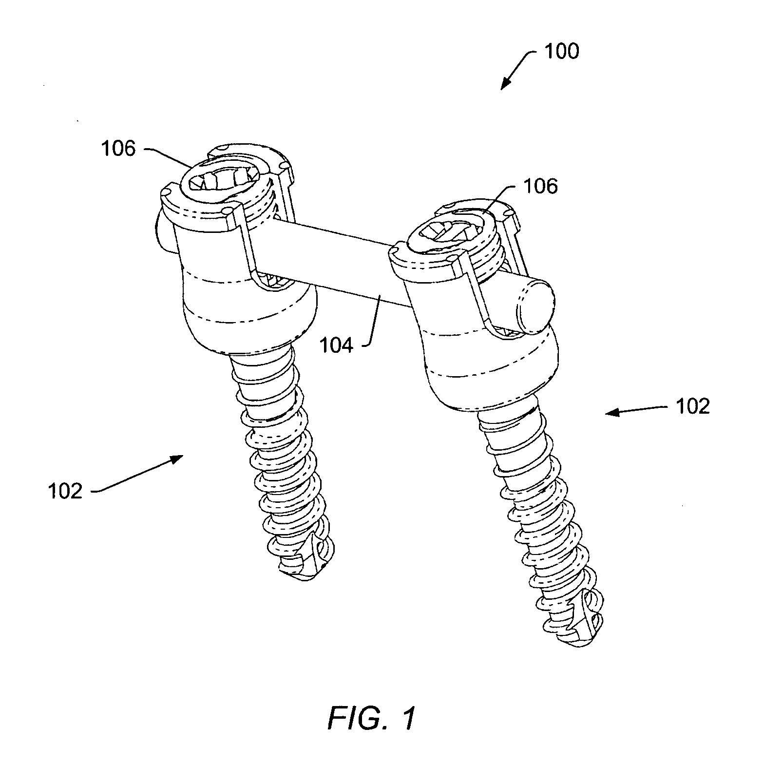 Instruments and methods for adjusting separation distance of vertebral bodies with a minimally invasive spinal stabilization procedure