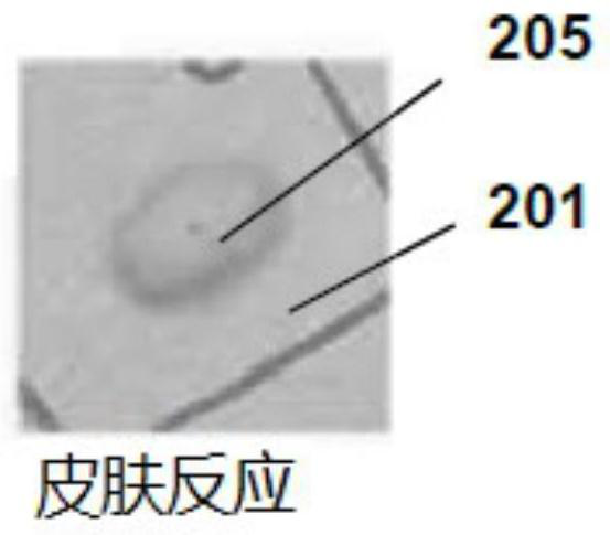 Electric device for skin allergy test