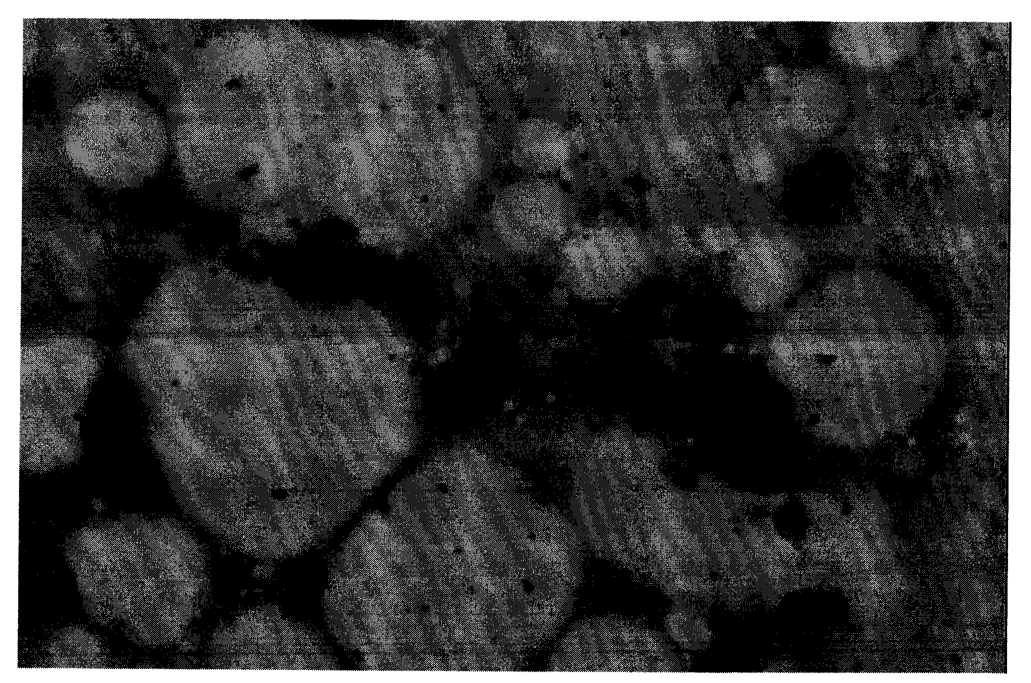 Method for building mouse severe aplastic anemia model