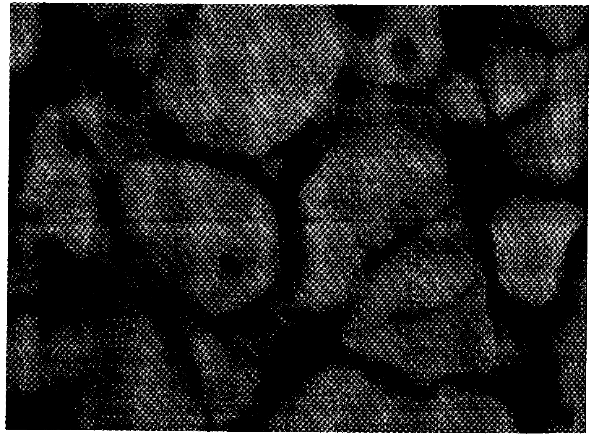 Method for building mouse severe aplastic anemia model