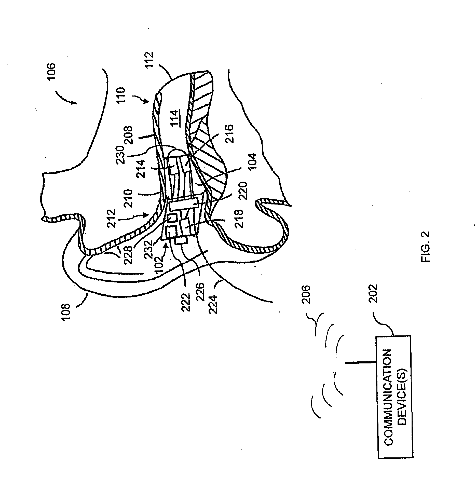 Methods and devices for radio frequency (RF) mitigation proximate the ear