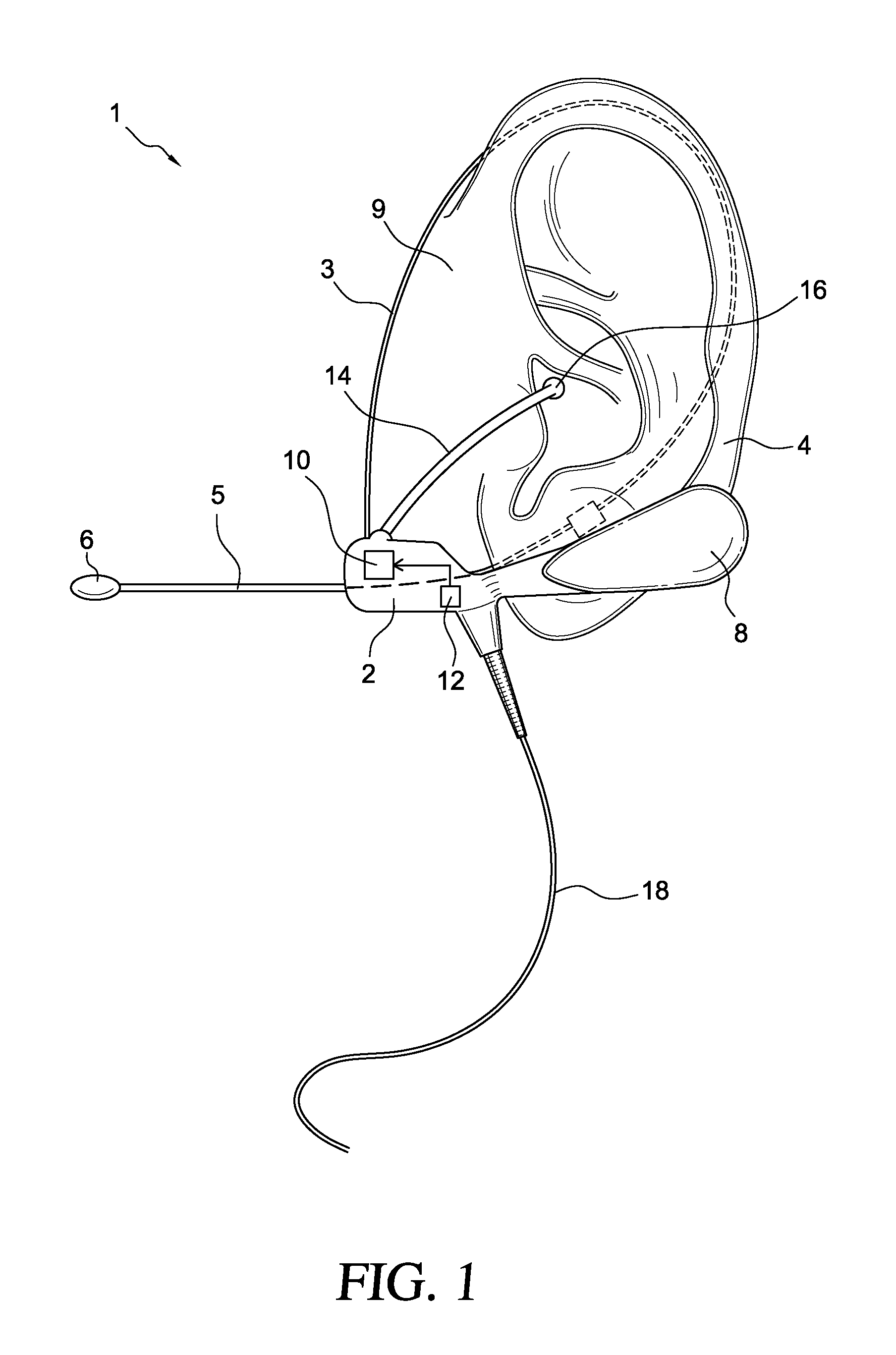 Headset for fitting of an earpiece