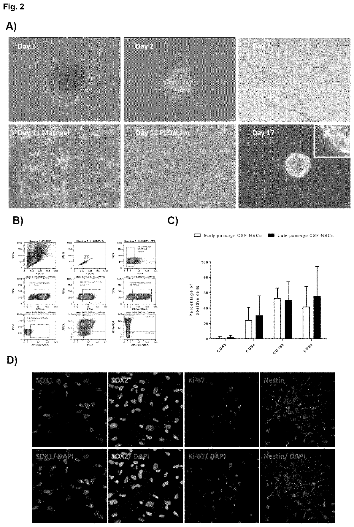 Hemorrhagic cerebrospinal fluid neural stem cells