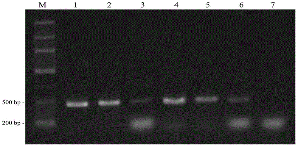 Method for detecting bursaphelenchus xylophilus, detection primer and LAMP (loop-mediated isothermal amplification) detection kit of detection primer